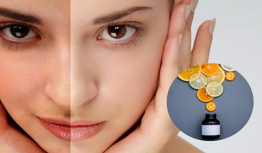 Vitamin C có tác dụng gì cho da? Một số lưu ý trong quá trình sử dụng Vitamin C